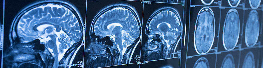 Featured Image for Daydreaming Styles and Brain Functional Connectivity